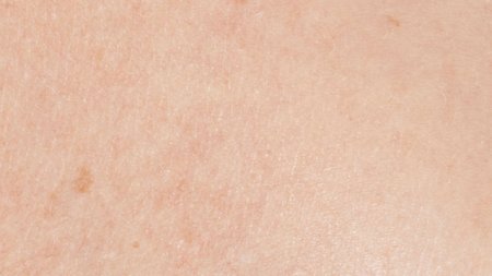 Sensitive or Intolerant Skin
