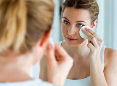 Woman with acne-prone skin cleaning her face